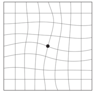 amsler grid